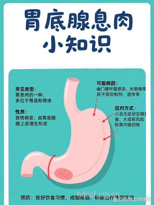 胃息肉有哪几种类型 胃息肉的症状有哪些