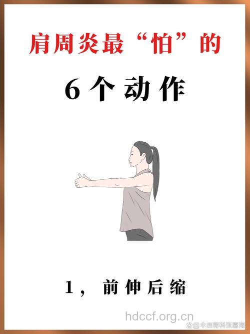 什么运动方法可治疗肩周炎