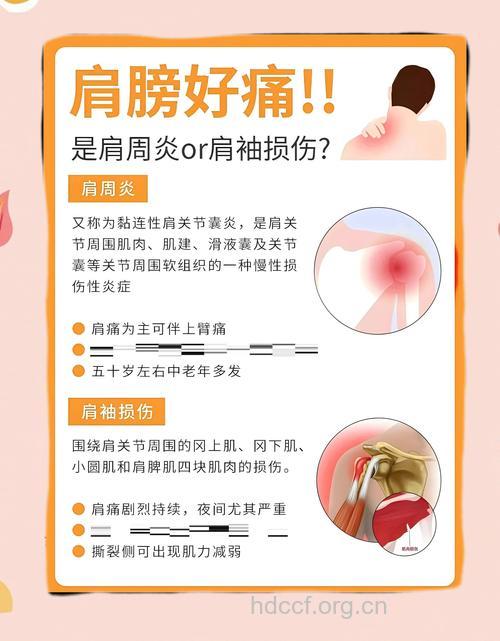 肩周炎的疾病简介
