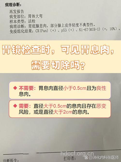 胃息肉如何辨别及检查方法