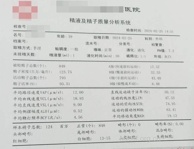 精液液化不超30分钟 男性高质量精子的标准