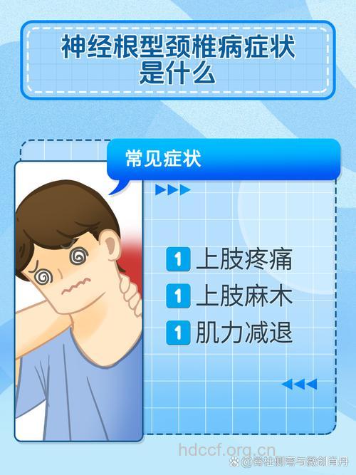 颈椎病的根性症状表现