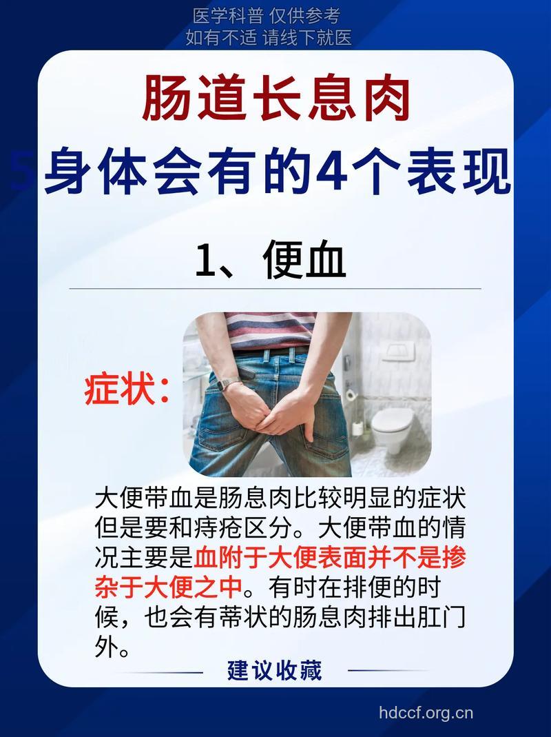 肠息肉的几种常见症状