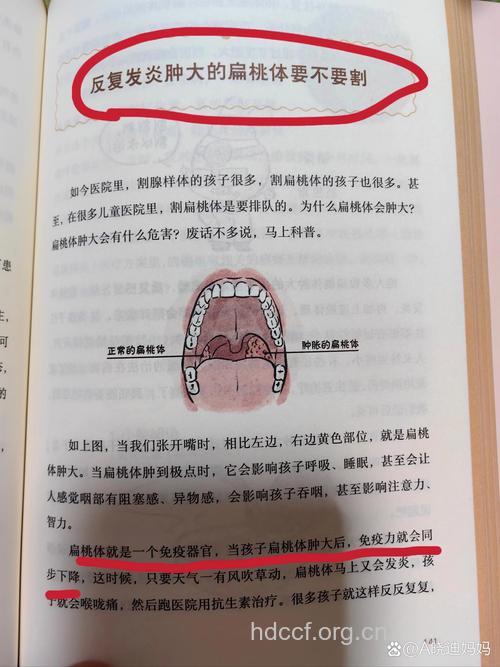 孩子扁桃体炎是否该切除?