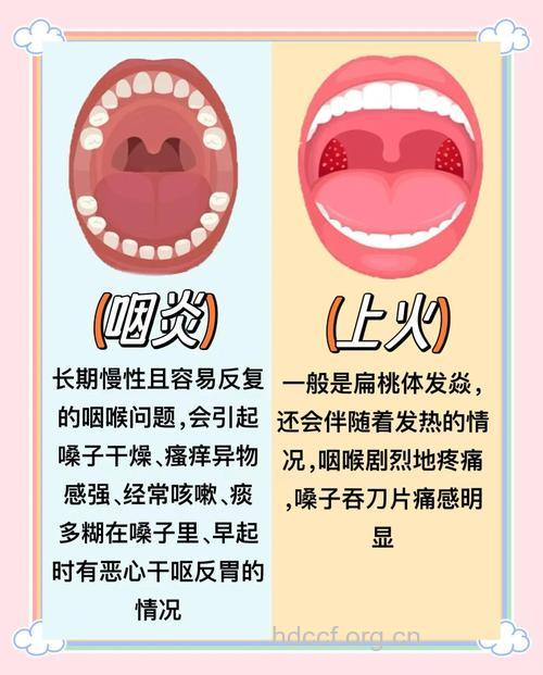多种咽喉口腔源于上火