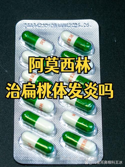 急慢性扁桃体炎,用药不同