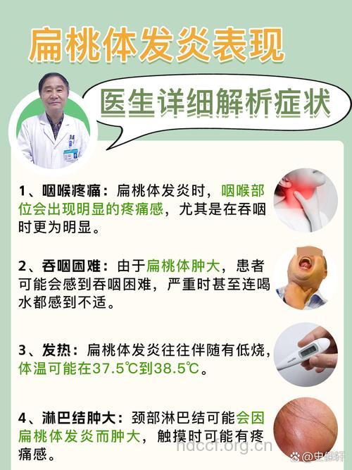 白领也易得扁桃体炎