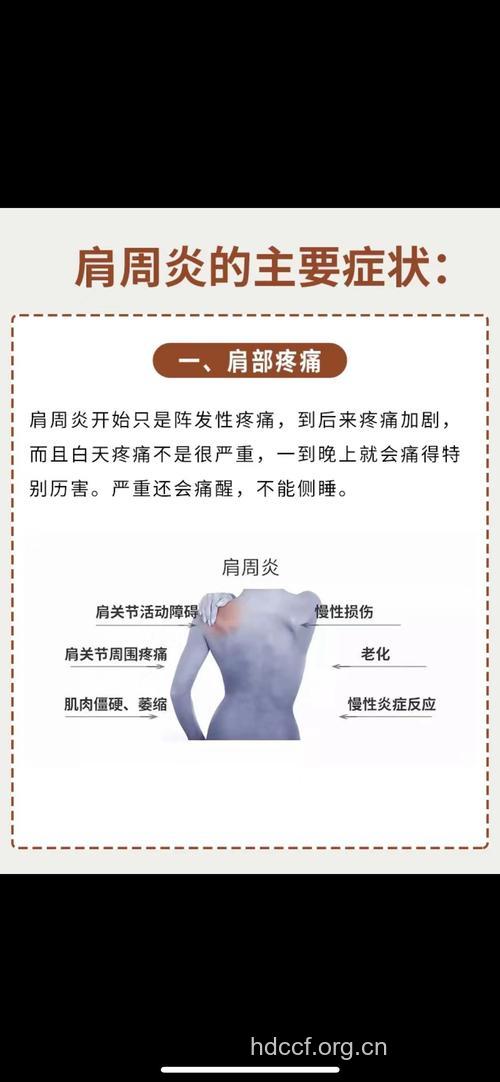 不同时期肩周炎的症状有哪些呢