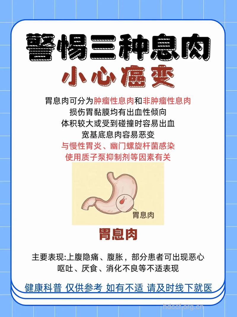 胃息肉与肠息肉有何不同?