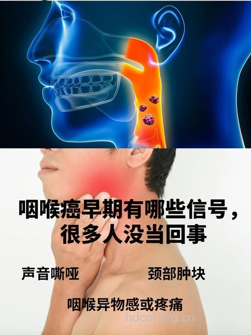 警惕 口臭耳聋或为扁桃体癌