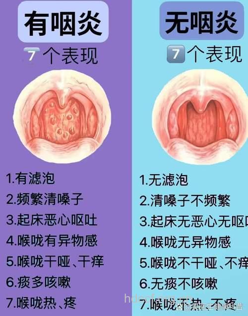 咽部异物感 究竟什么病？