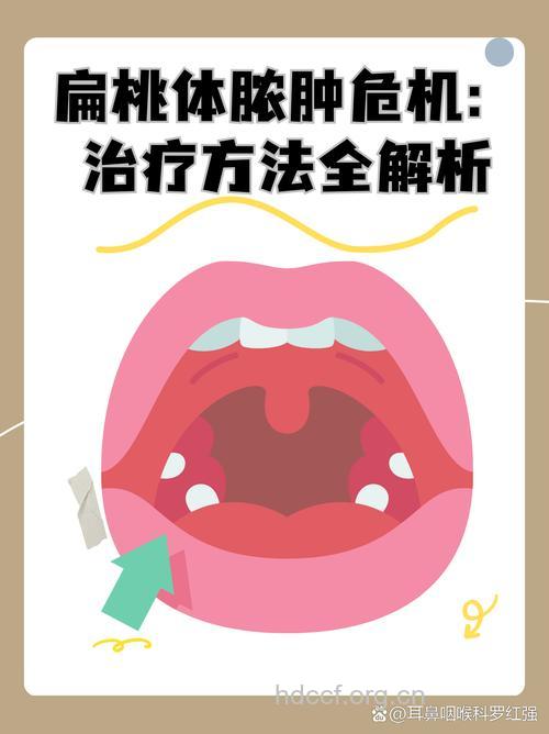 解说咽旁脓肿的几大病因