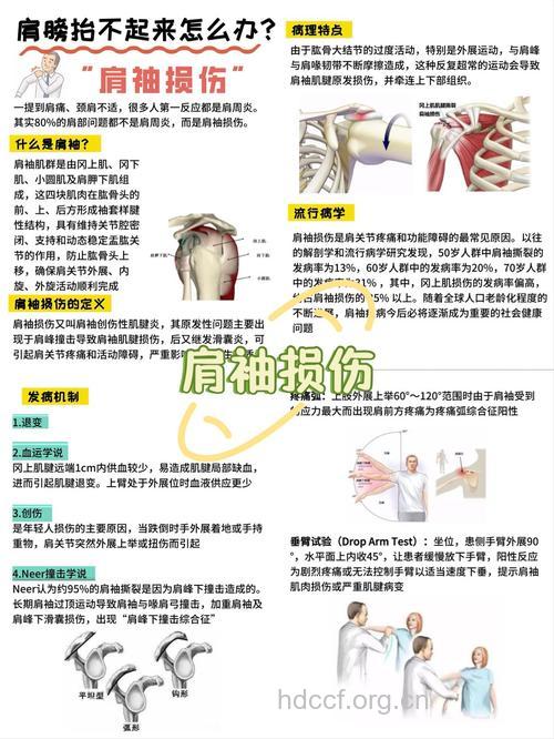 肩周炎患者的不同痛苦等级