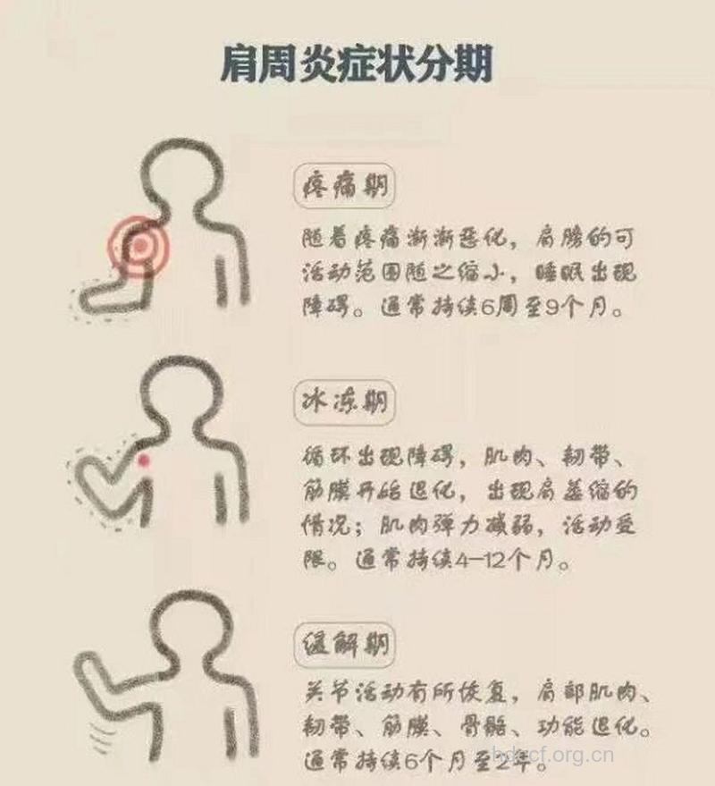 肩周炎症状的分期有哪些？