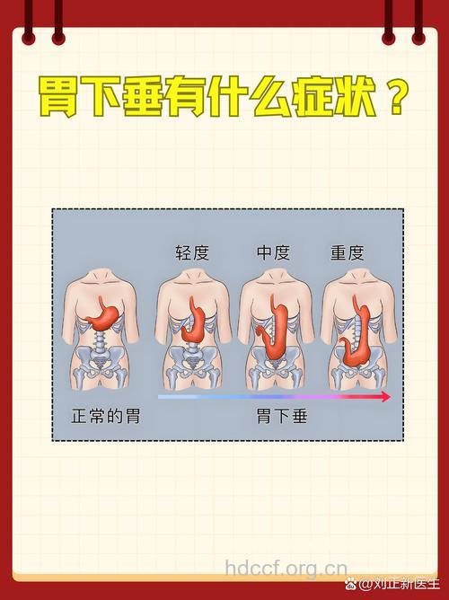 饭后的几种行为容易导致胃下垂