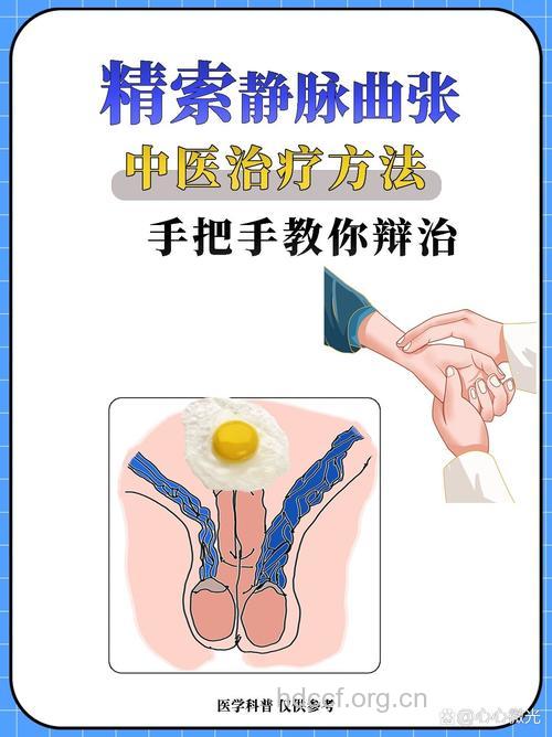 中医治疗精索静脉曲张方法
