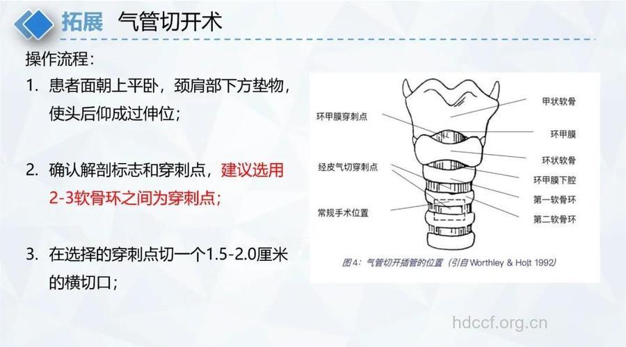 专家解析:手术法治疗喉气管狭窄