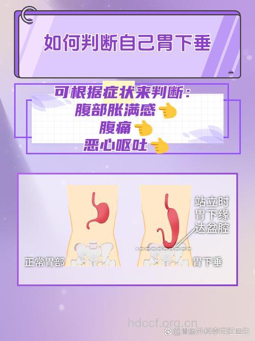 胃下垂为何如此青睐干瘦女性