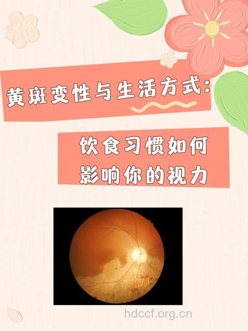 黄斑变性导致视力受影响 食疗方来帮助你