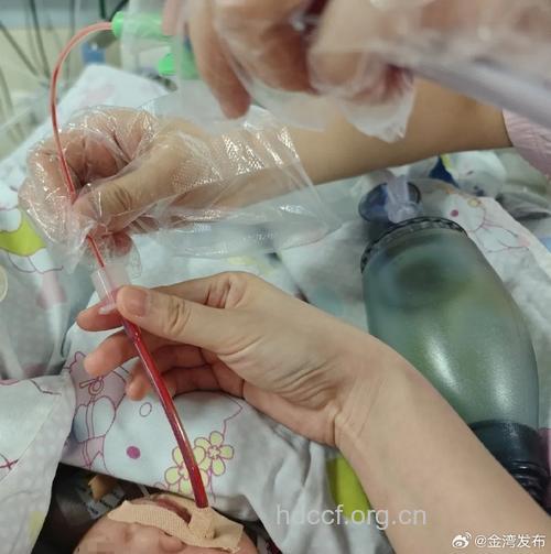 奶奶喂食 幼儿患胃出血