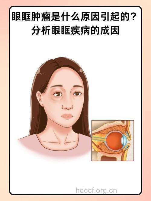 出现6种症状 当心是眼眶肿瘤