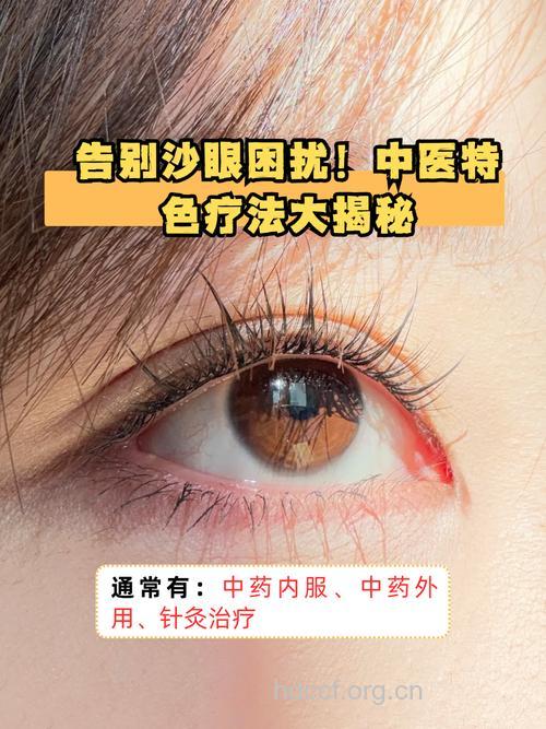 盘点三种治沙眼的中医疗法