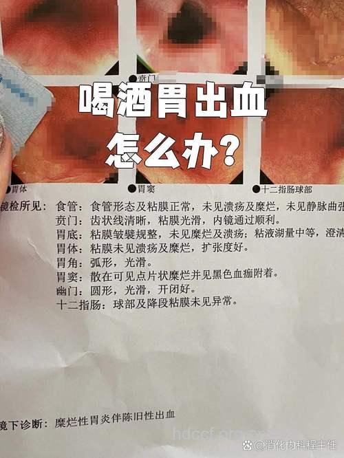 酒后胃出血了怎么办