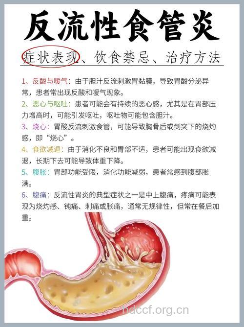 反流性食道炎的五大危害
