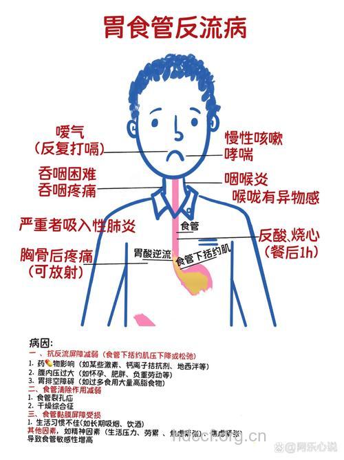 你知道胃食管反流病发的原因吗