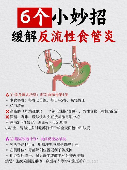 反流性食道炎怎么治疗呢