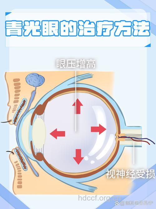 青光眼最佳治疗方法 青光眼的原因