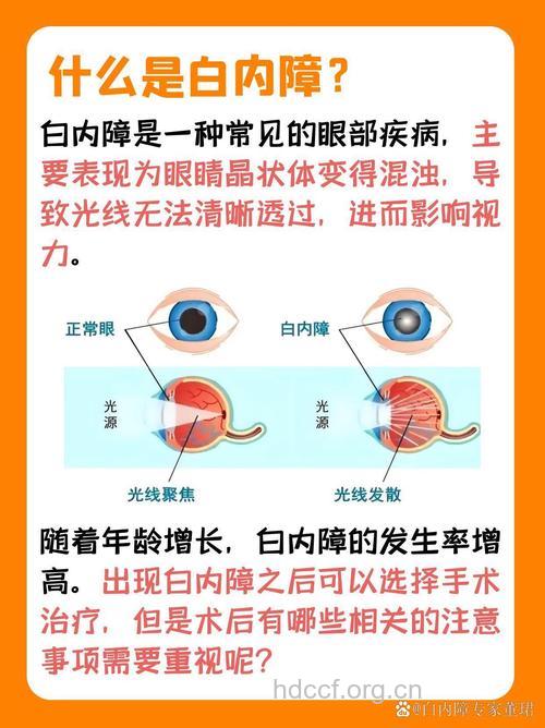 什么是白内障 白内障的症状与治疗