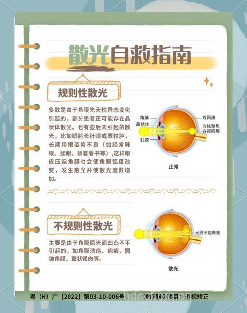 3种方法帮助你矫正散光