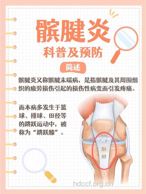 膝关节炎的发病与什么有关