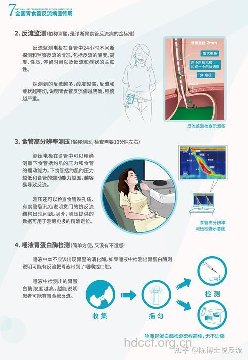 反流性食道炎的检查方法