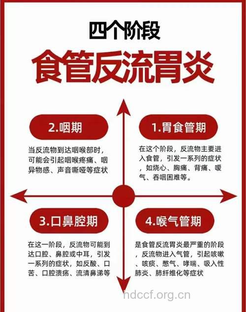 胃食管反流病易被确诊为呼吸道疾病
