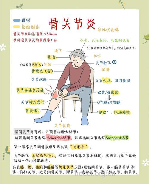 关节炎的发病与哪些因素有关