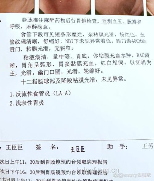 胃食管反流病的诊断及检查