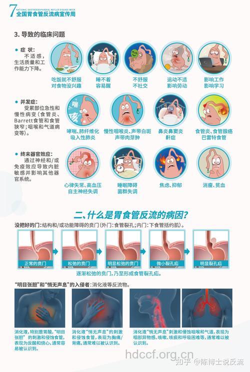 胃食管反流诊断新方法