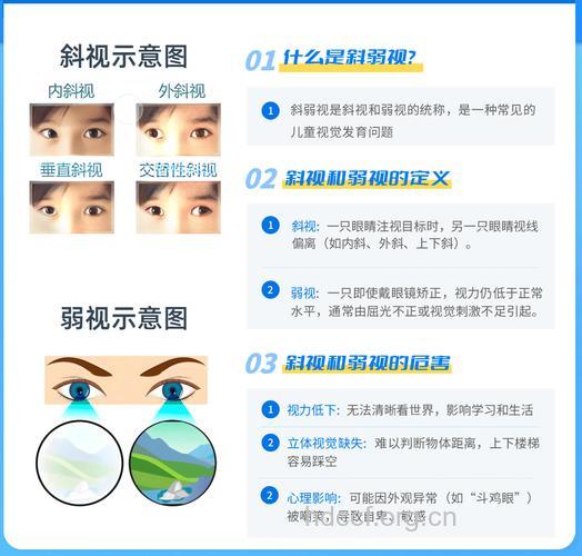 两种治疗儿童斜视的方法