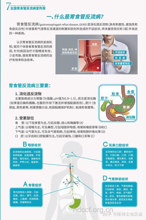 胃食管反流有哪些治疗措施