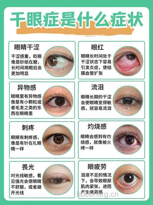 干眼症是因为缺少维生素A吗？