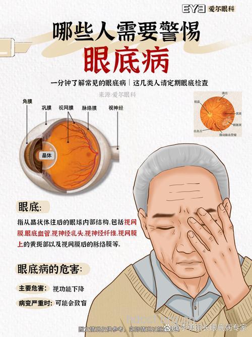 眼底病会引起6个危害 预防眼底病很重要