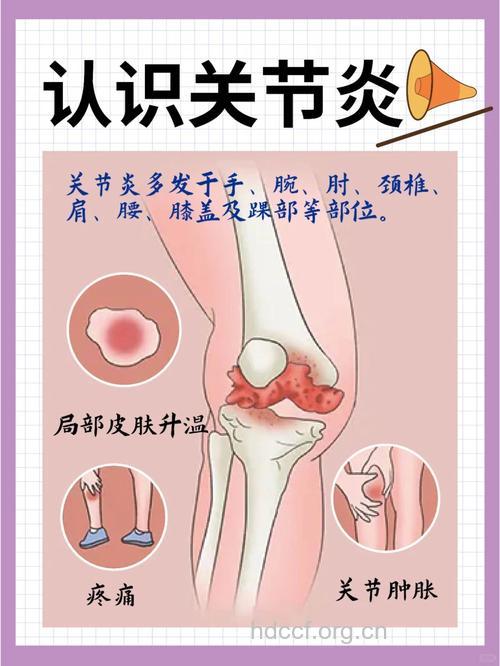 骨性关节炎的常见症状