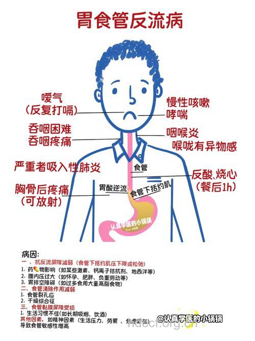 中医是怎样解说胃食管返流的病因的