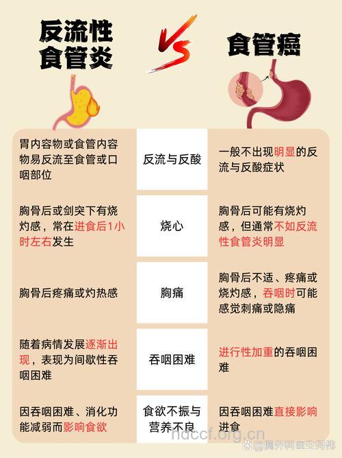 胃食管返流与食管癌有哪些关系