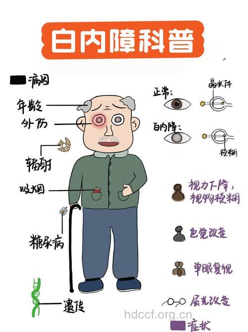 白内障的5大高发人群