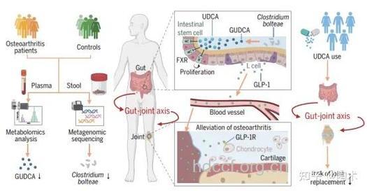 了解骨关节构造,明确骨关节炎发病机制