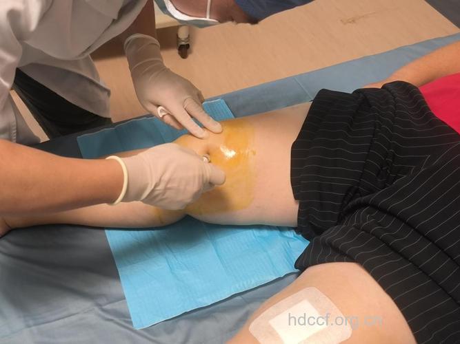 膝关节炎的非手术治疗