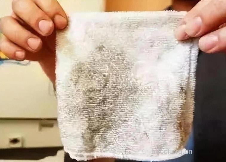 毛巾太脏也易致使不孕不育